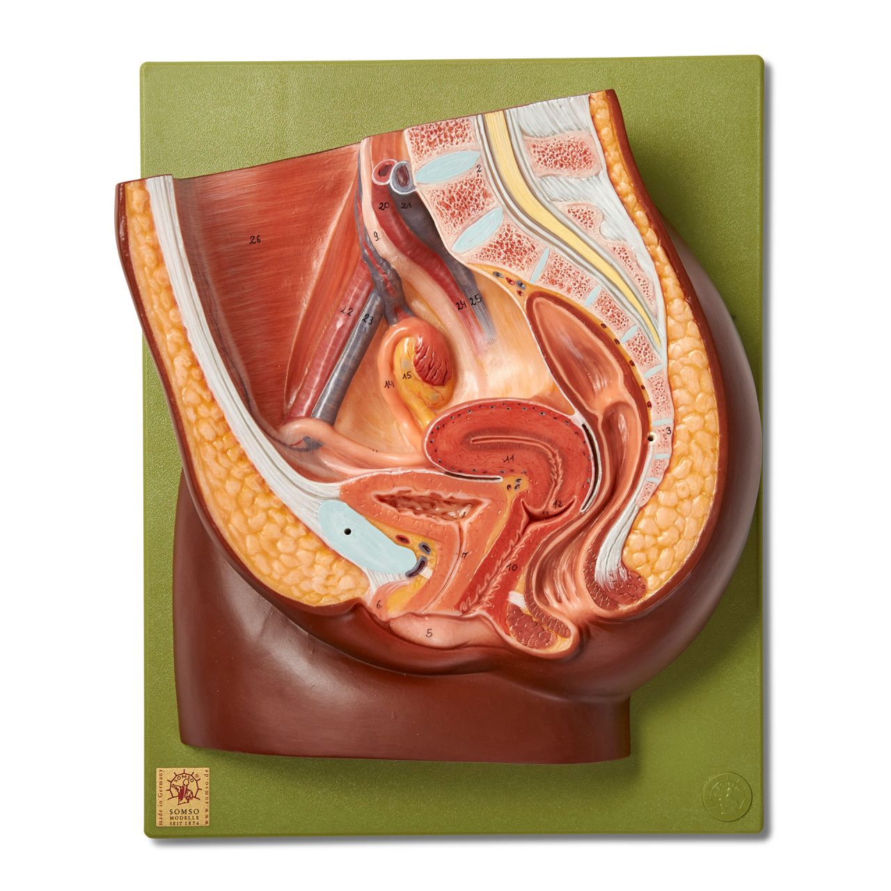 Median Section of Female Pelvis