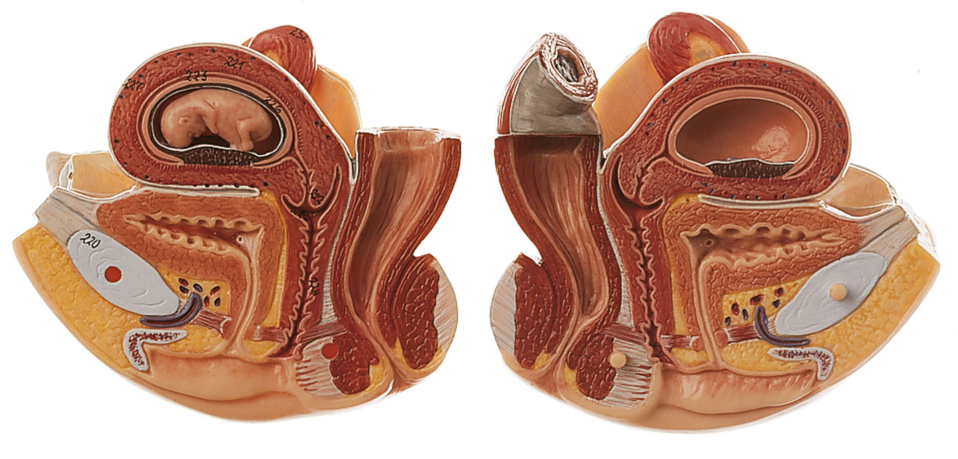 Interchangeable Female Genital Organs With a 10-Week-Old Fetus