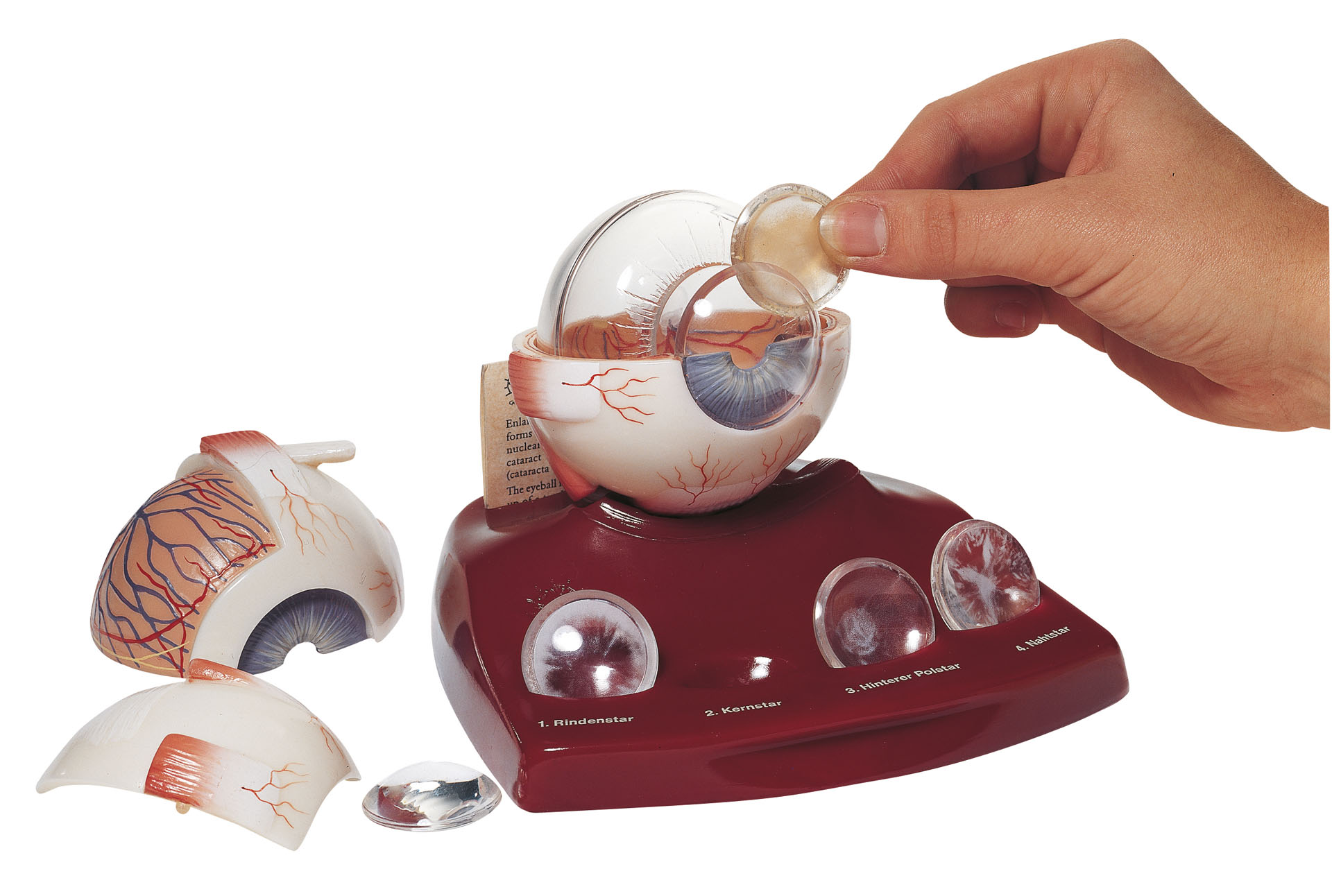 Cataract Eye Model