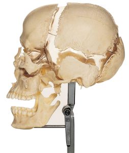 Artificial Bauchene Skull of an Adult