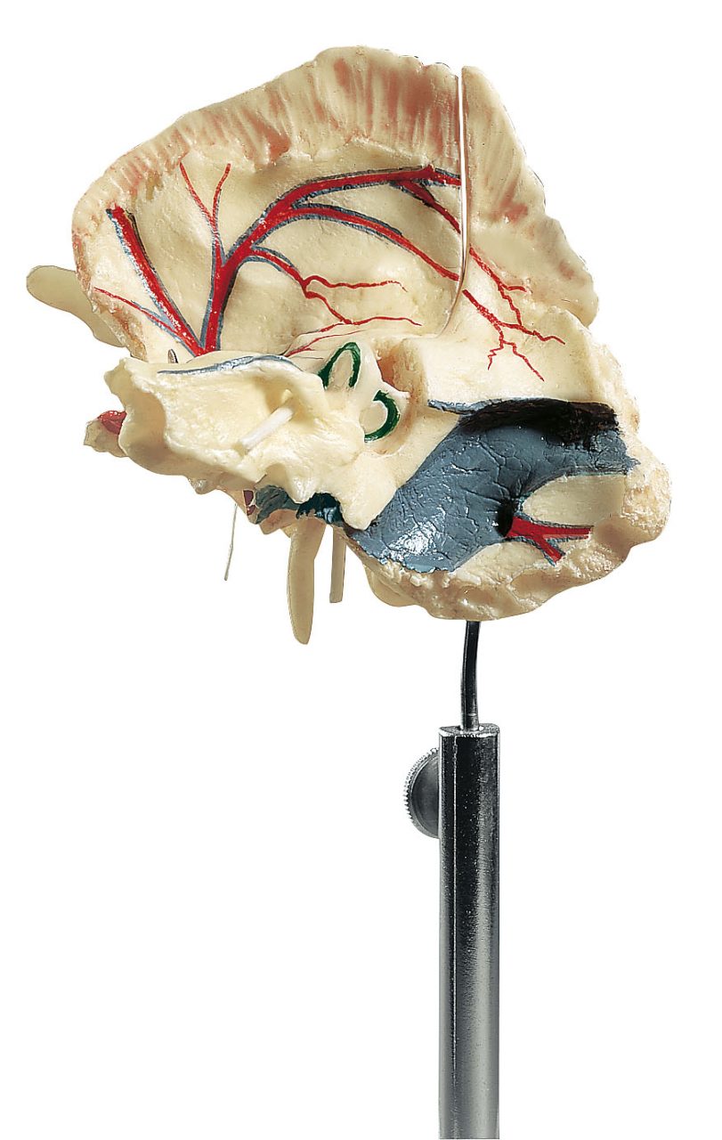 Artificial Temporal Bone