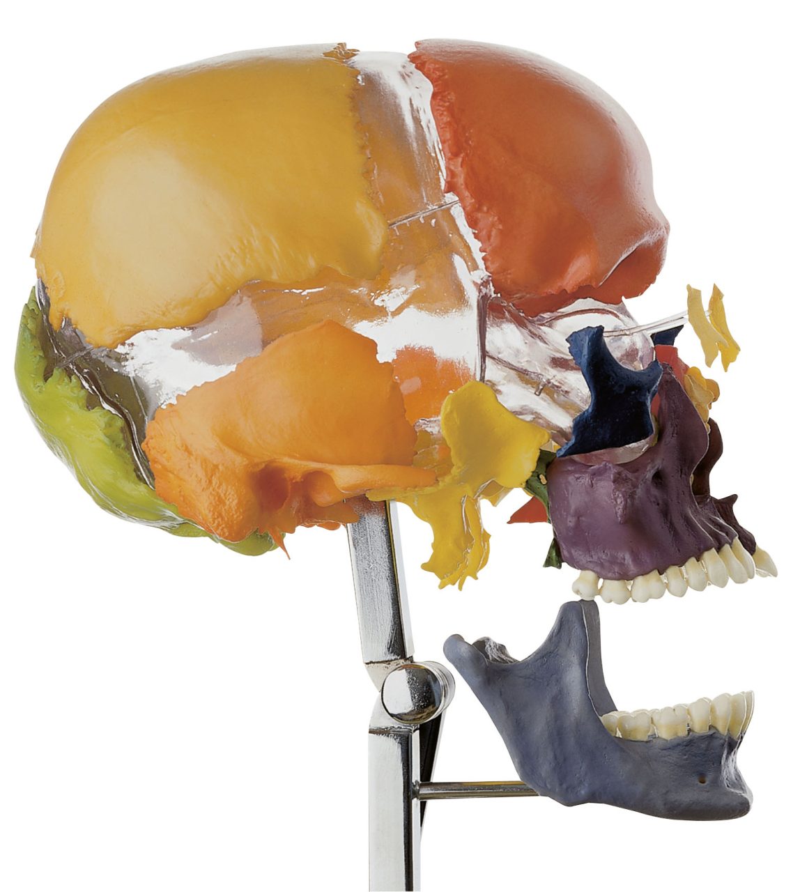 Artificial Bauchene Skull of an Adult