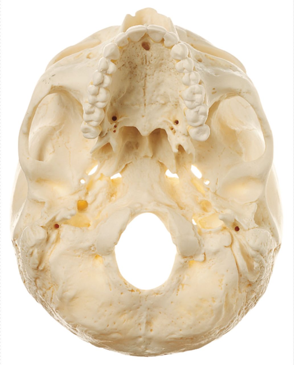 Artificial Base of the Skull