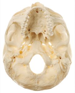 Artificial Base of the Skull