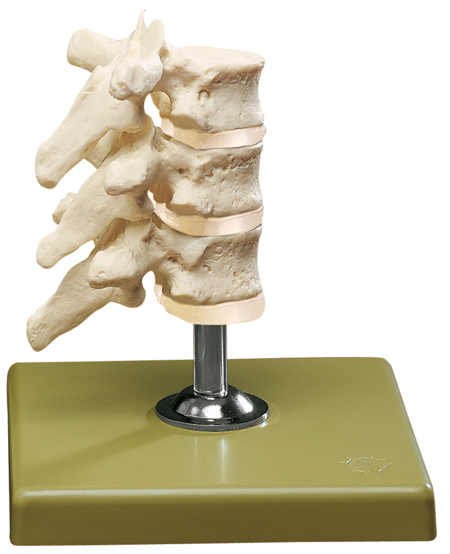 Three Thoracic Vertebrae With Discs