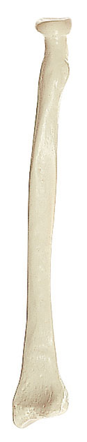 Radius
