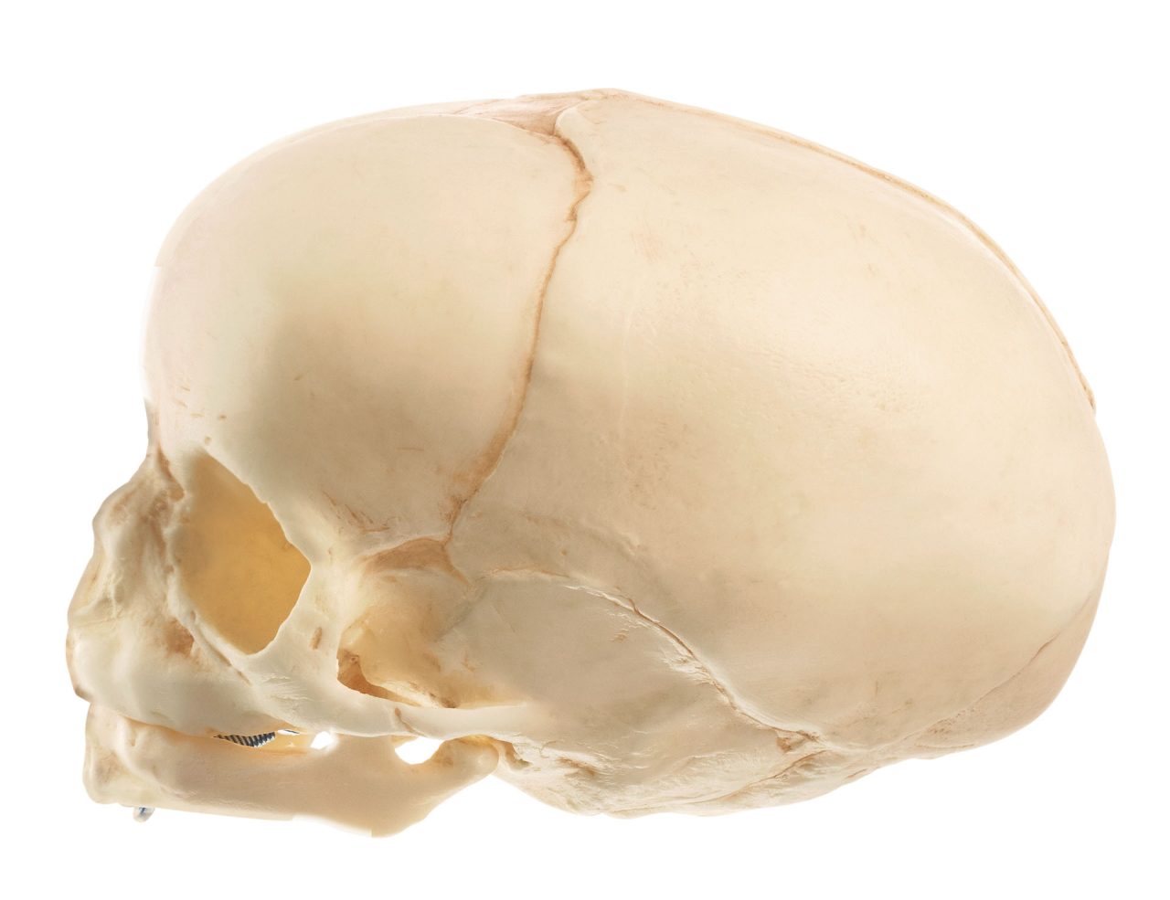 Fetal Skull