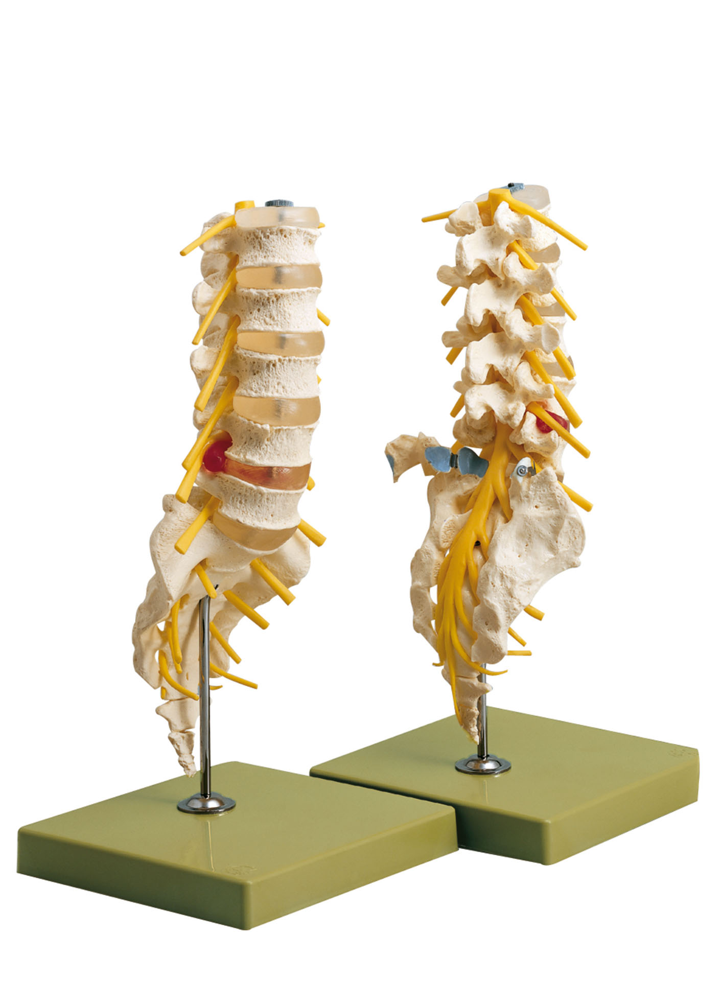 Lumbar Vertebral Column