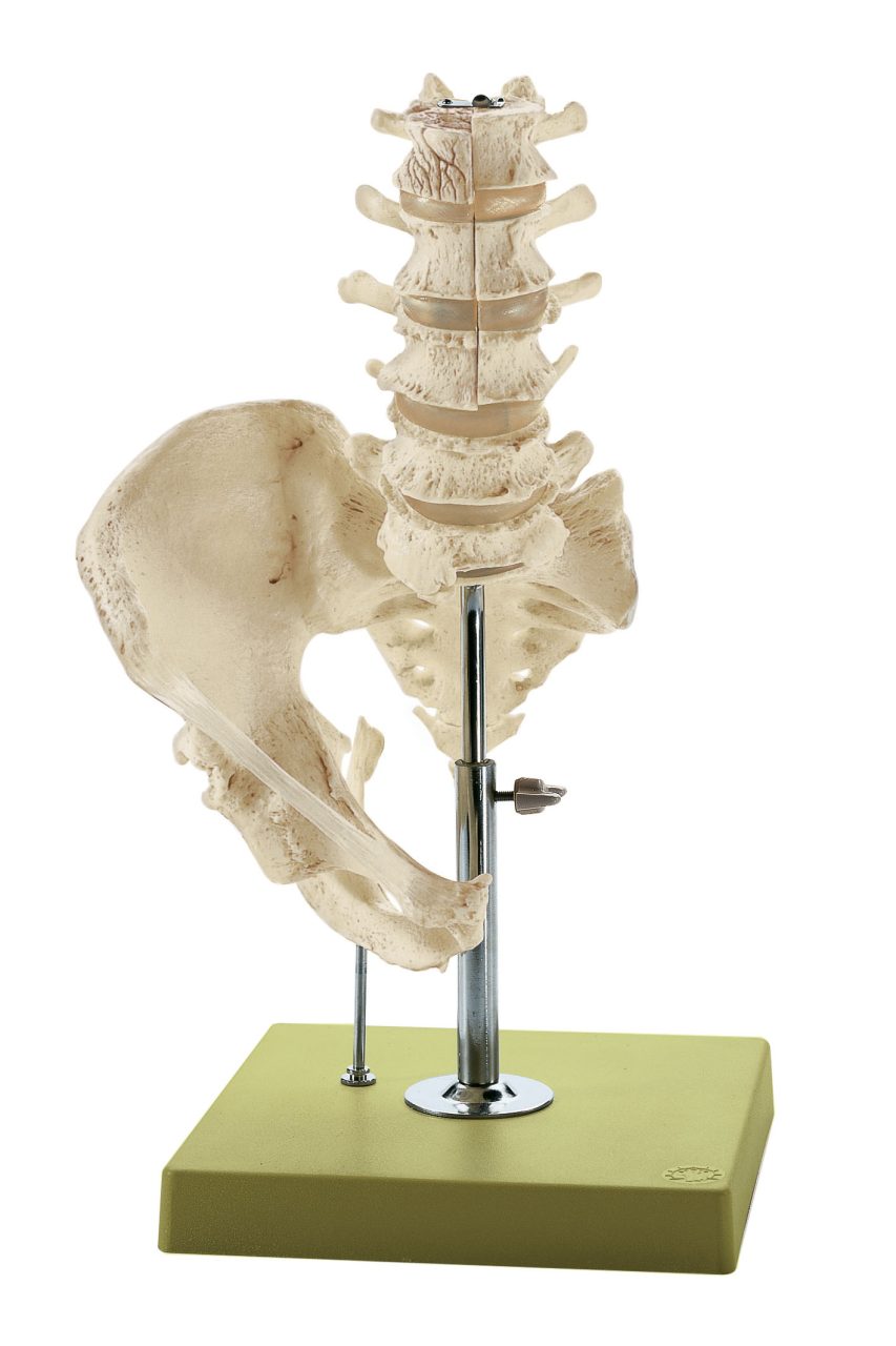 Lumbar Spinal Column - Without Innervation