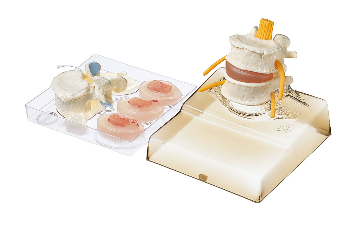 Intervertebral Disc Model