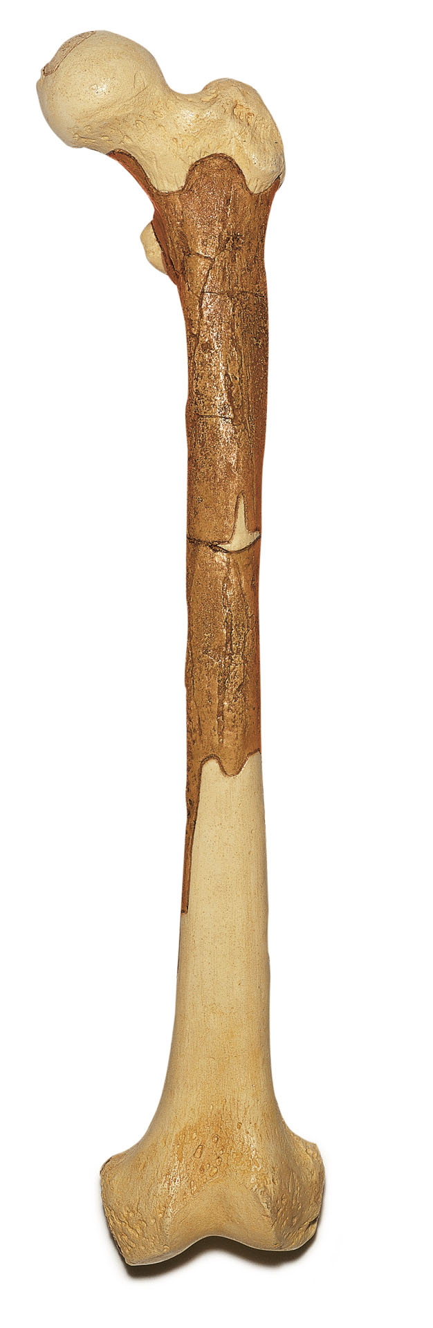 Reconstruction of a Thigh of Homo Ergaster
