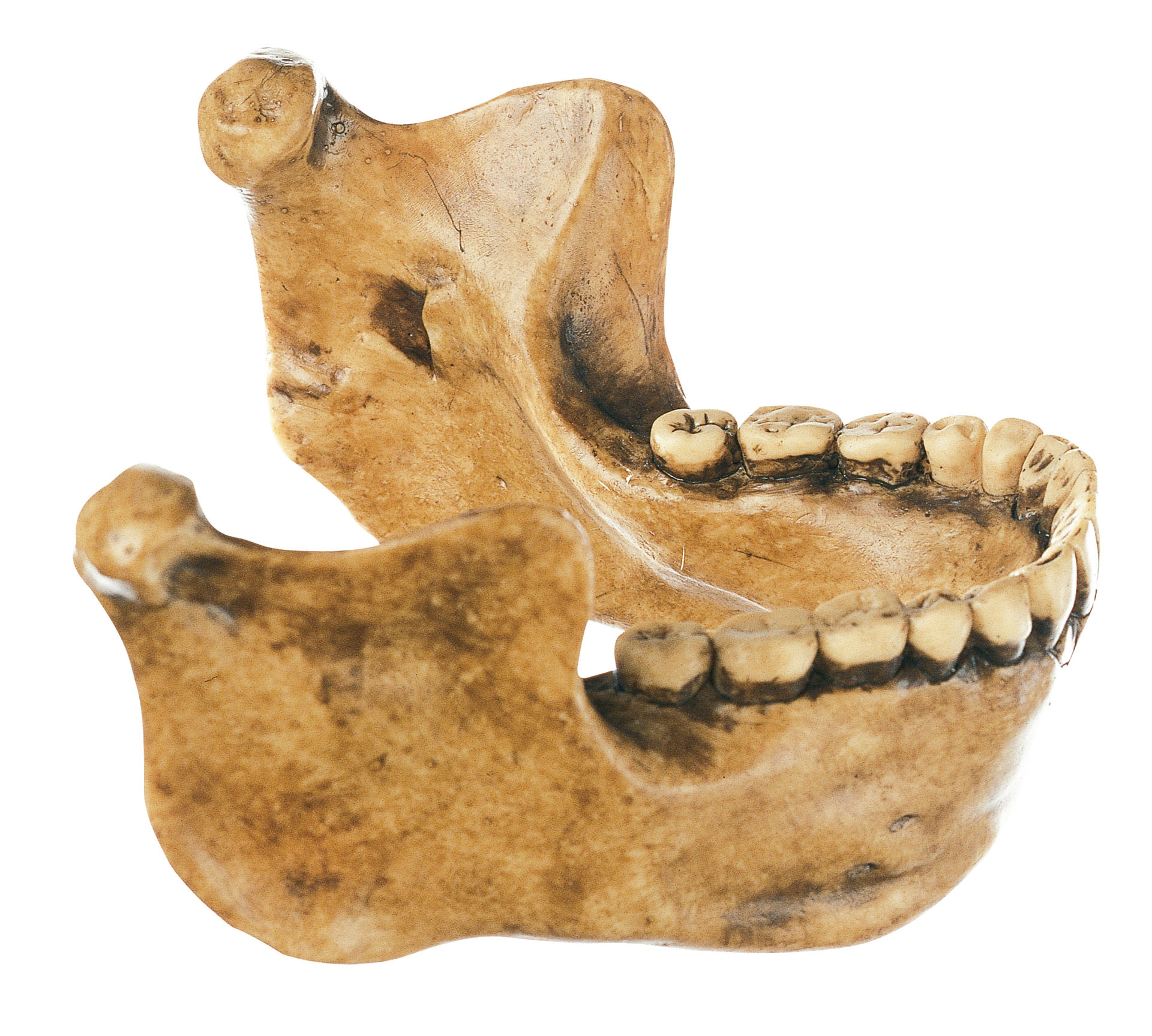 Lower Jaw Frommauer Near Heidelberg, Homo Heidelbergensis