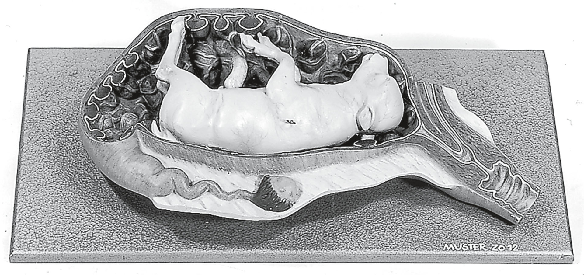 Uterus of the Cow