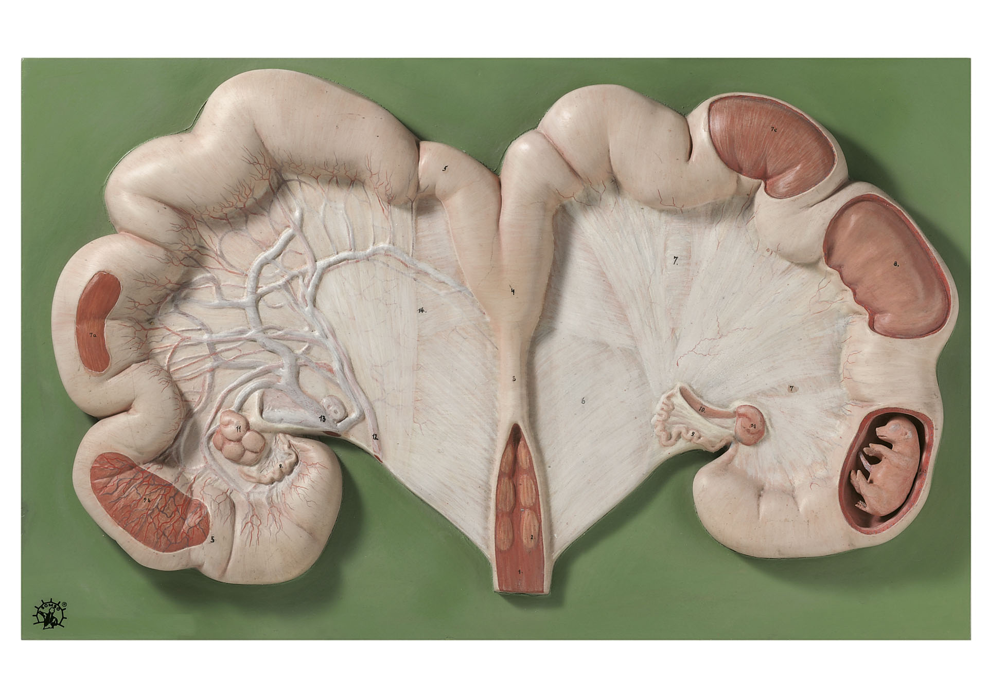 Uterus of the Pig With Fetus