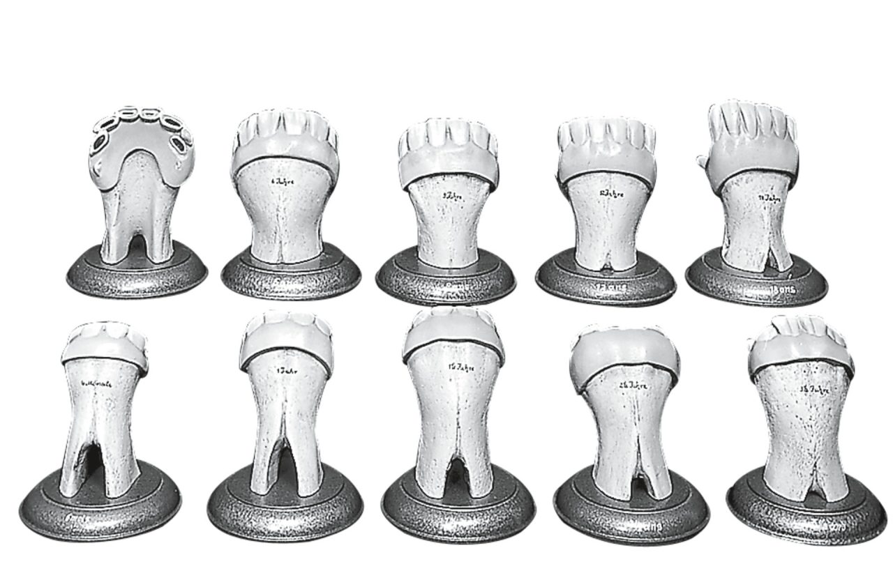 Sets of Teeth of a Horse