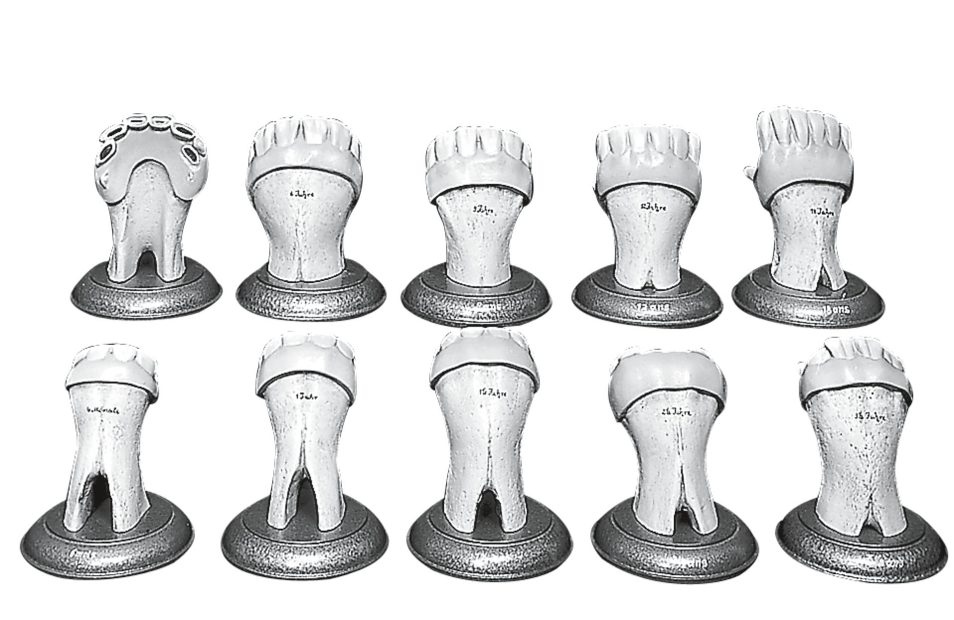 Sets of Teeth of a Horse