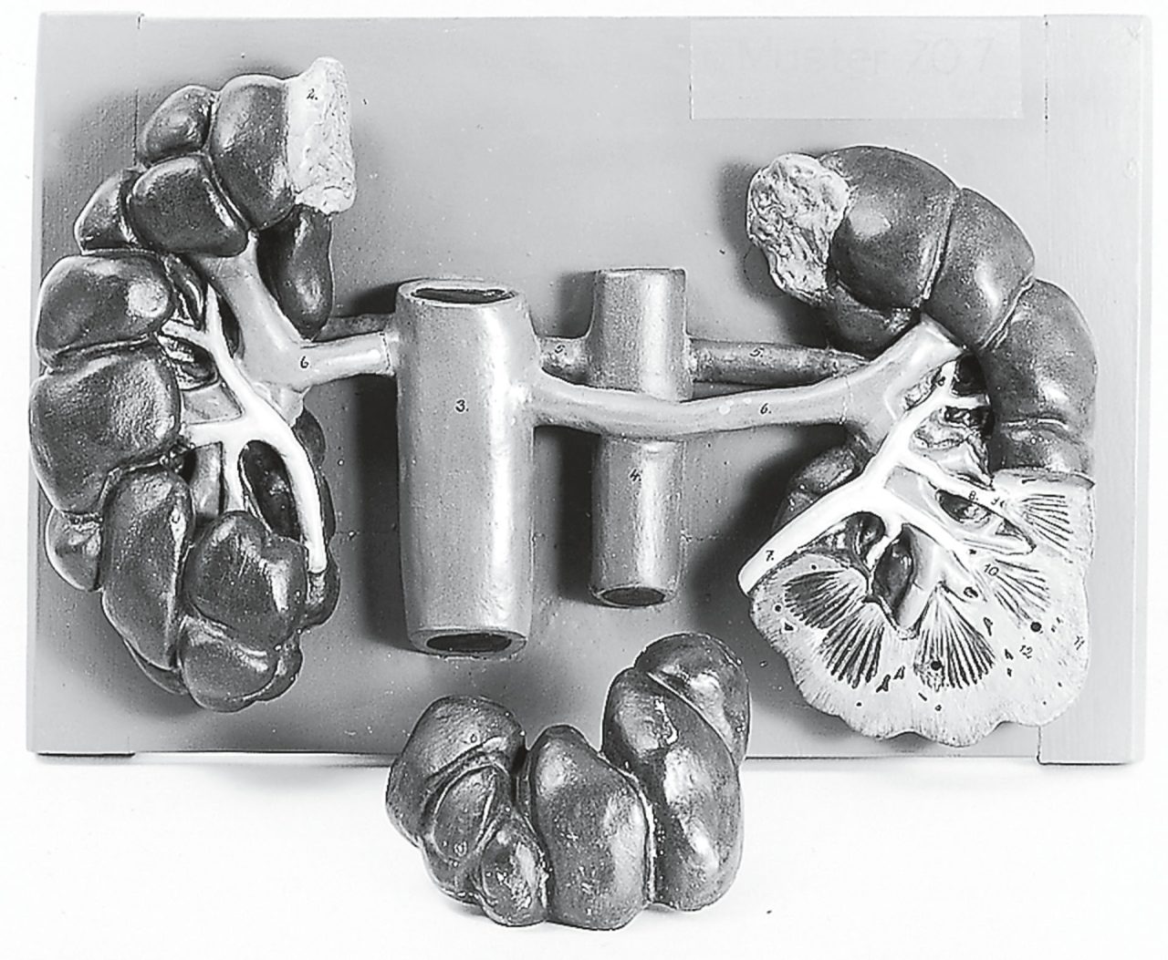 Kidneys of the Cow
