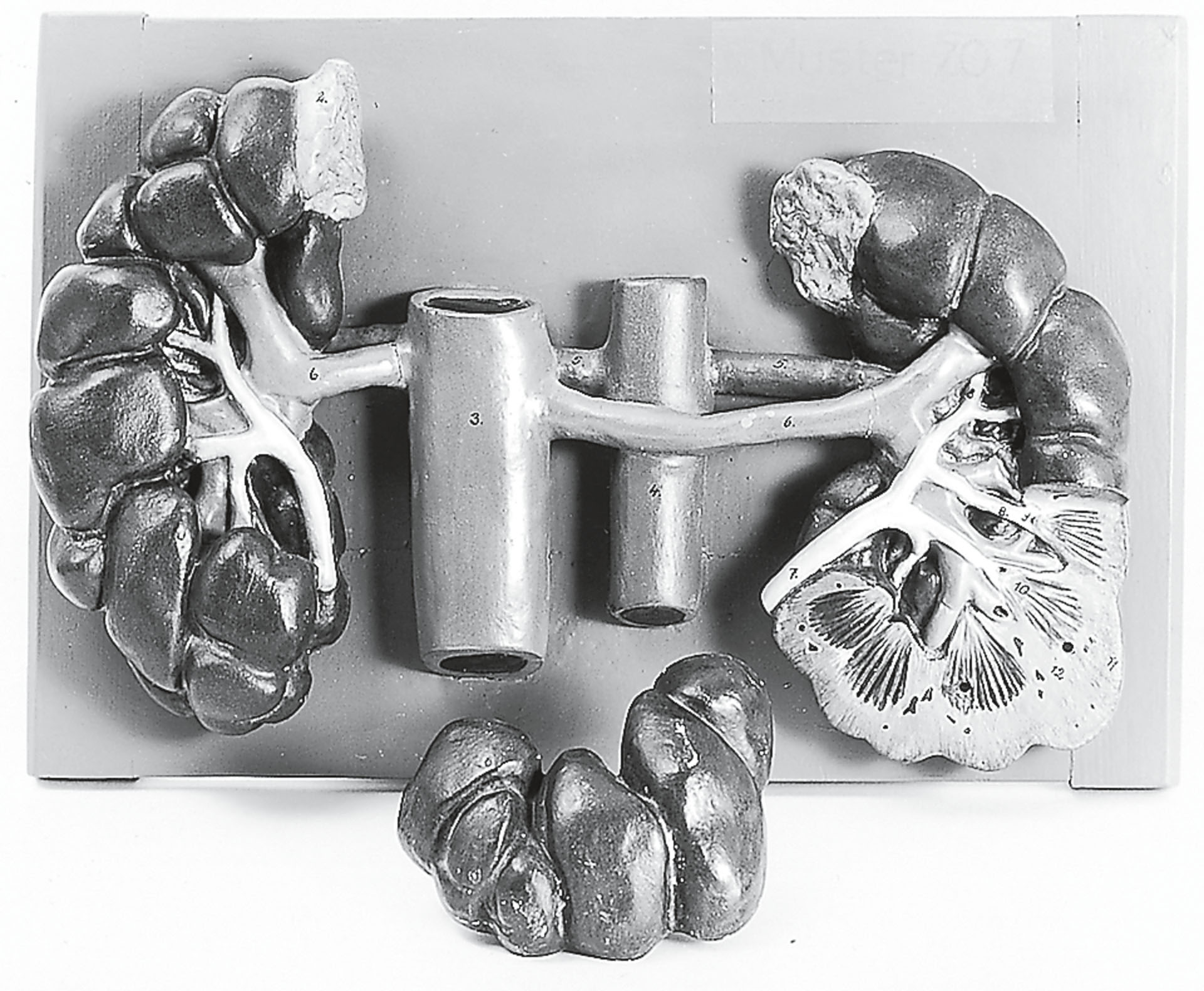 Kidneys of the Cow