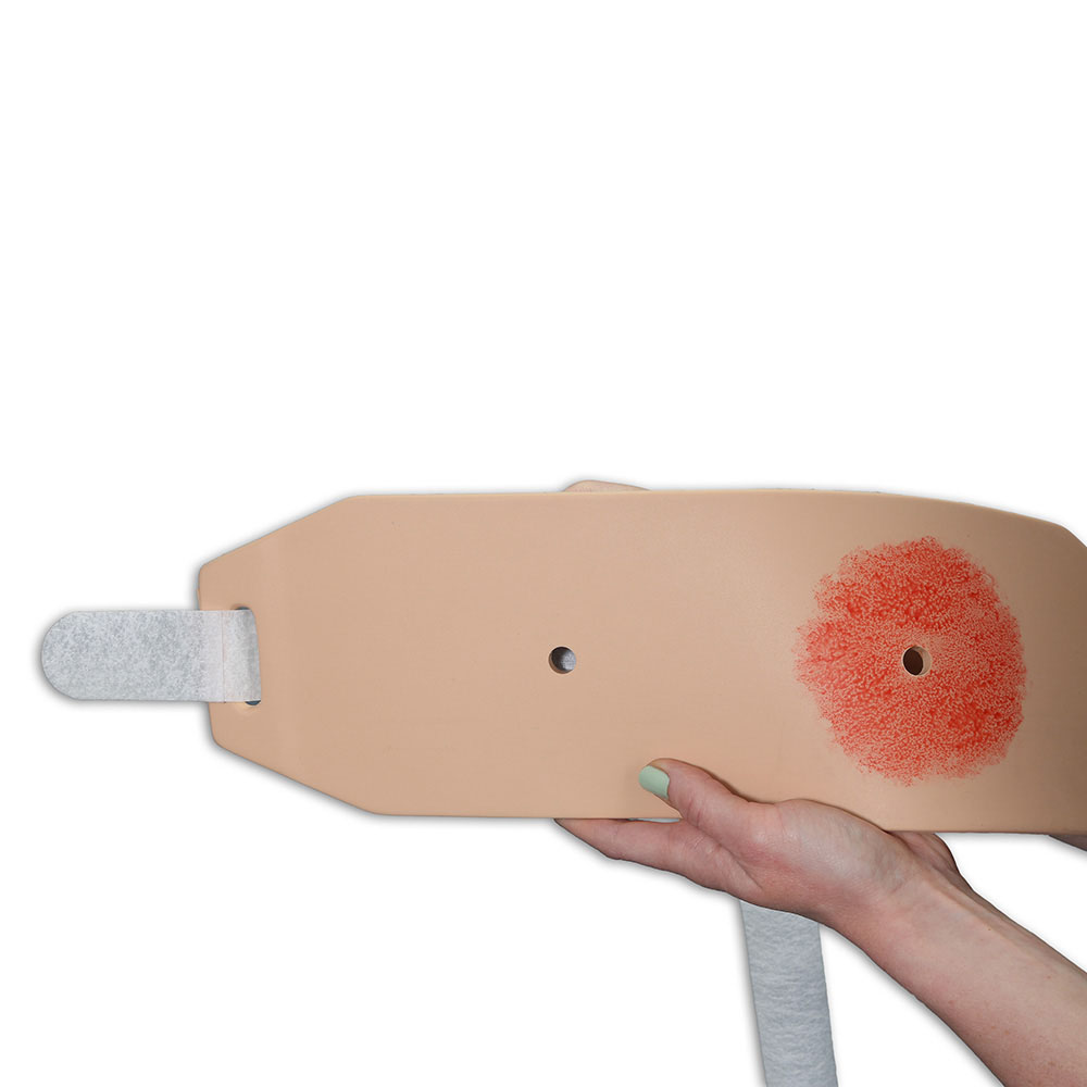Ostomy Pouching Trainer™ Model