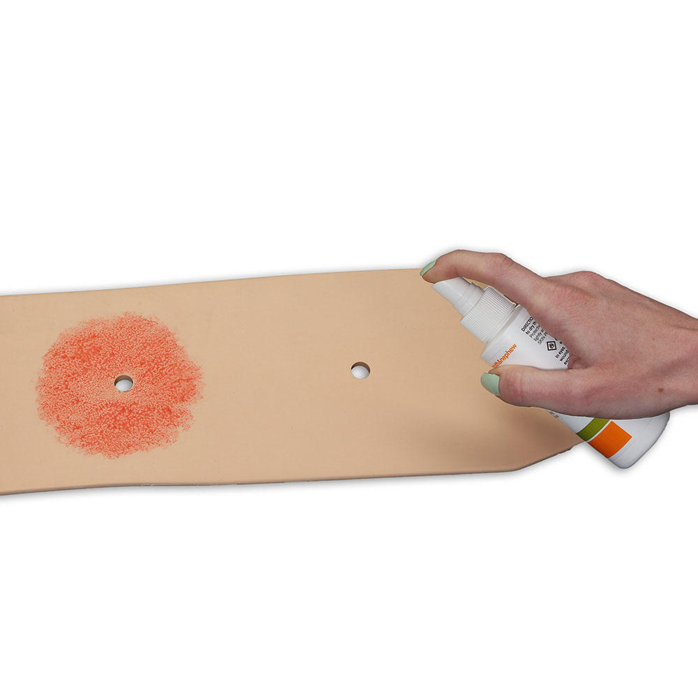 Ostomy Pouching Trainer™ Model