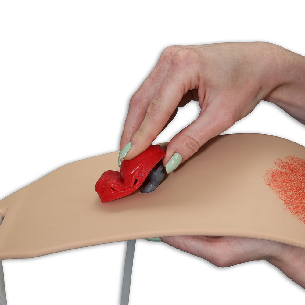 Ostomy Pouching Trainer™ Model