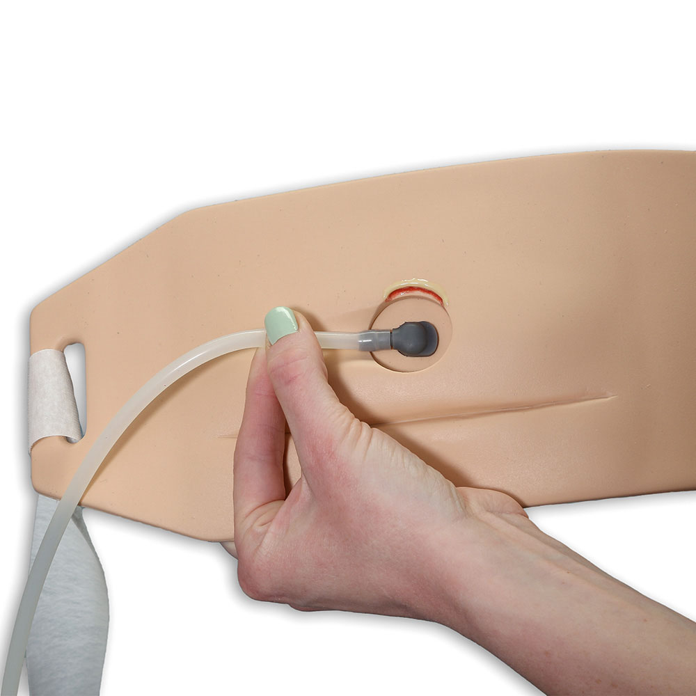 Ostomy Pouching Trainer™ Model