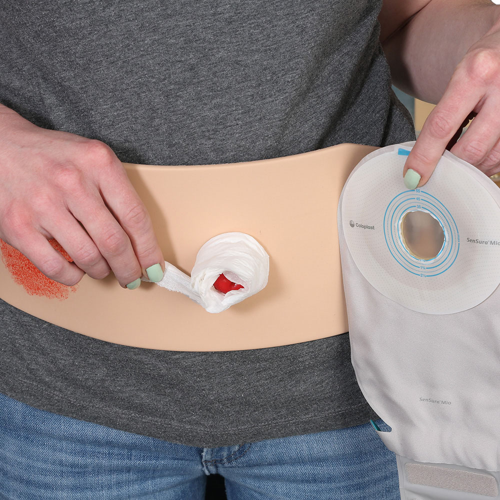 Ostomy Pouching Trainer™ Model