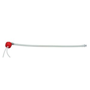 Replacement Urostomy Stoma with Stents