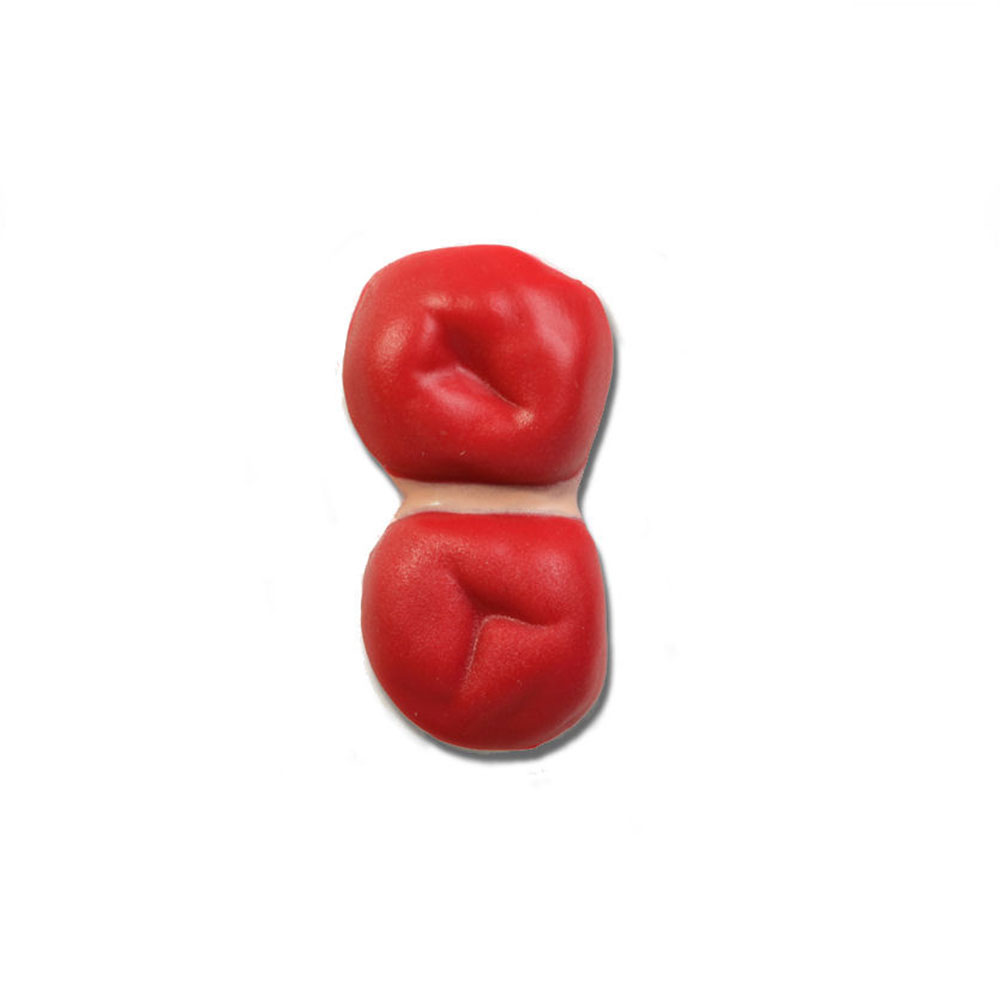 Double Barrel Stoma