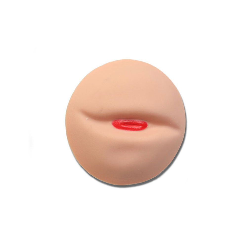In-Skin-Fold Stoma