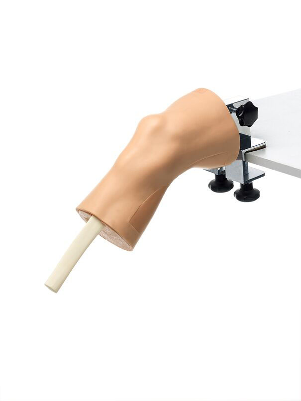 Arthroscopy Knee