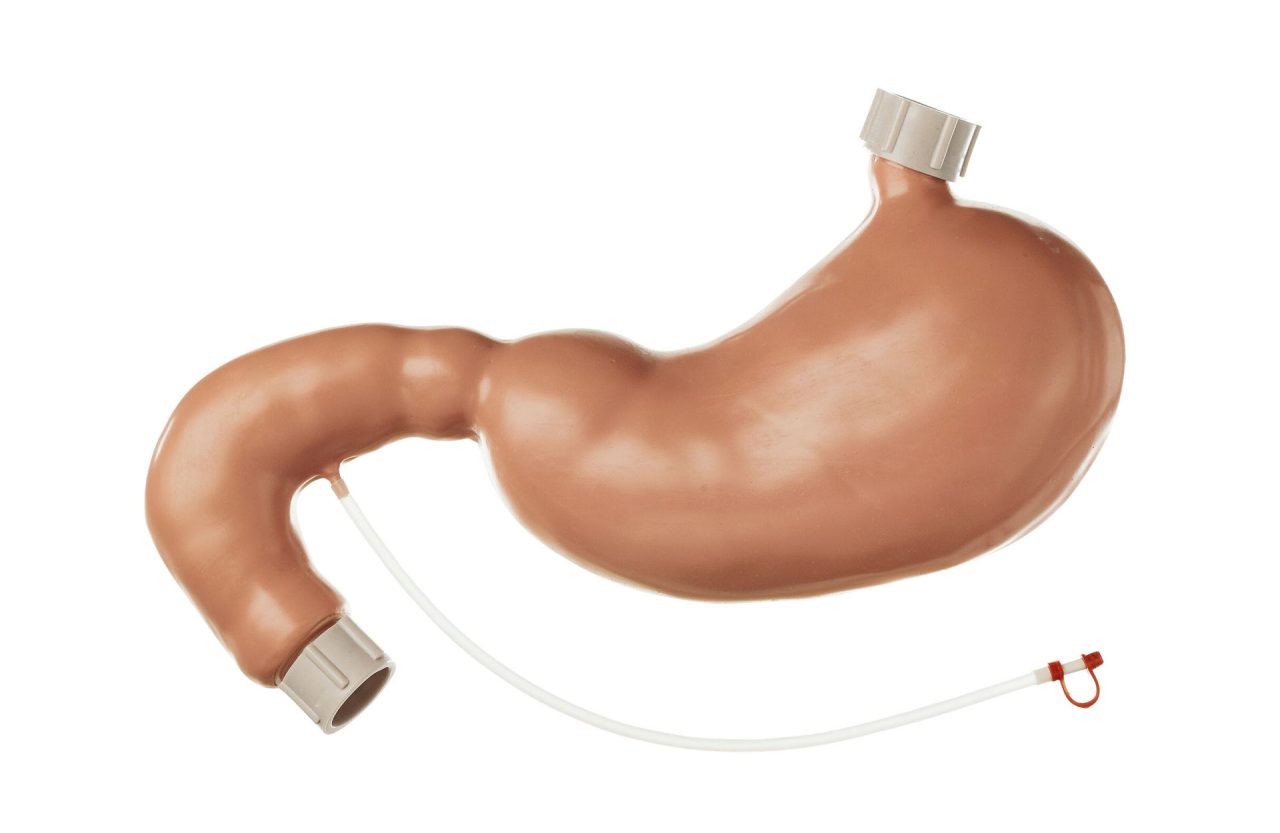 Stomach and Duodenum