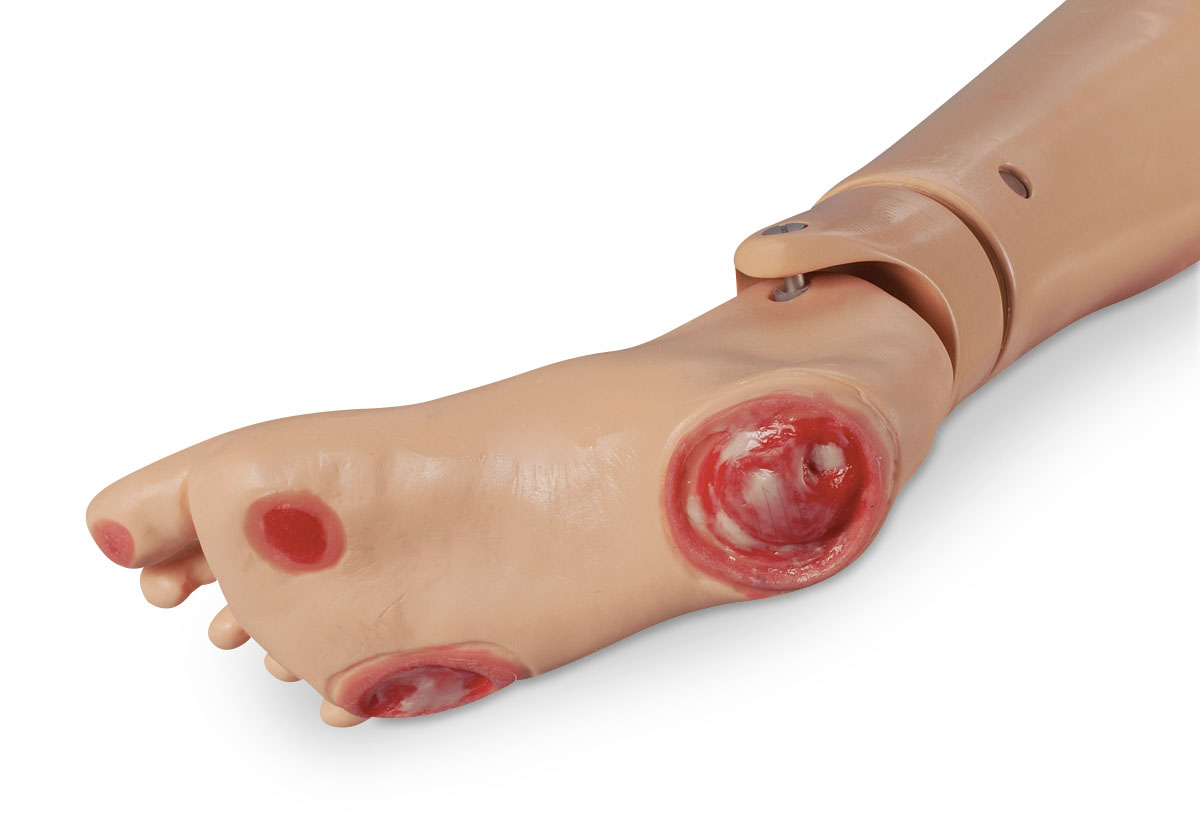 Pressure Wound Foot for Keri™ and Geri™ Manikins