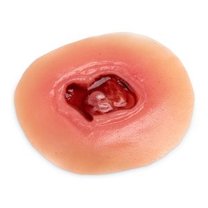 Nursing Care Wound Kit