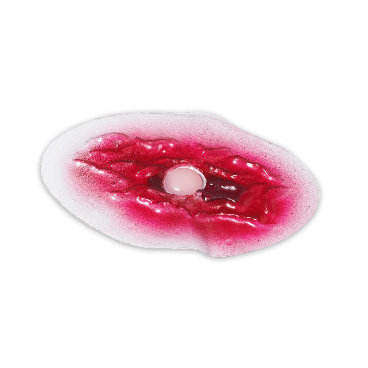Bladder Wound