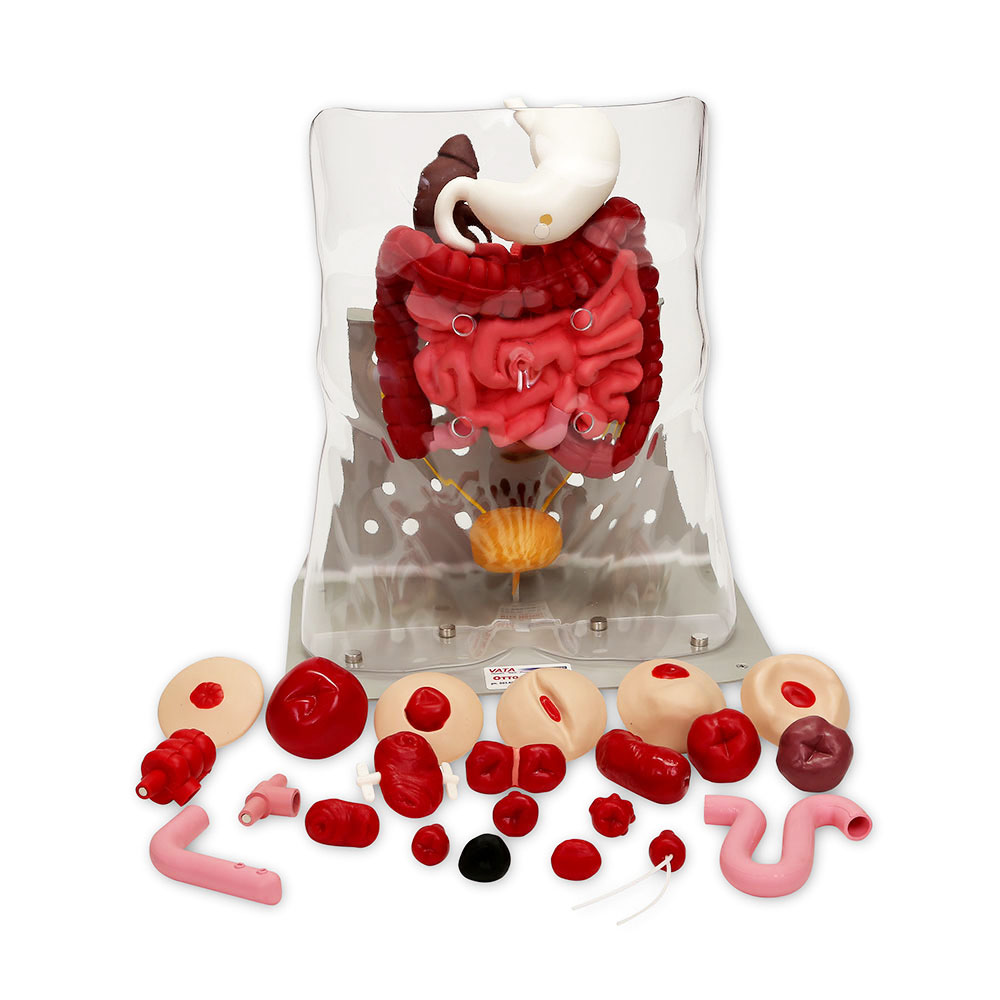 Otto Ostomy Model – Advanced