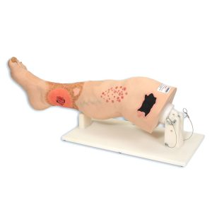 Vinnie Venous Insufficiency Leg™, Light