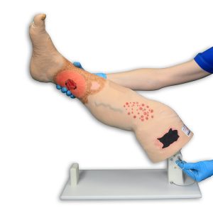 Vinnie Venous Insufficiency Leg™, Light