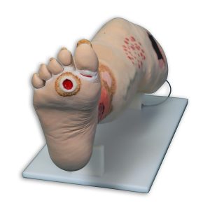 Vinnie Venous Insufficiency Leg™, Light