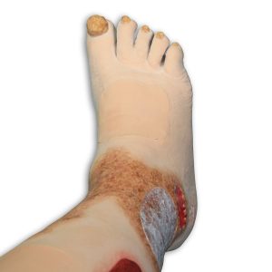 Vinnie Venous Insufficiency Leg™, Light