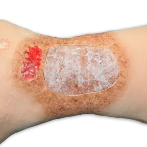 Vinnie Venous Insufficiency Leg™, Light