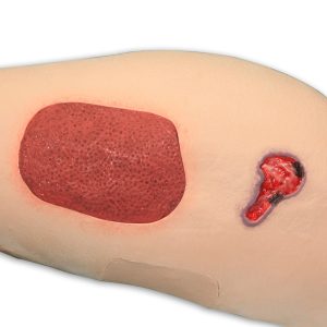 Vinnie Venous Insufficiency Leg™, Light