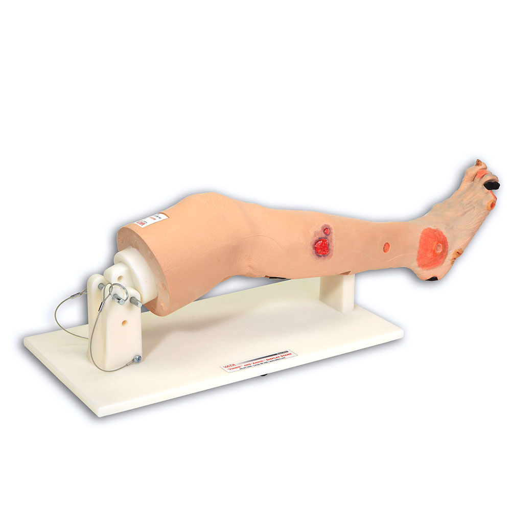 Annie Arterial Insufficiency Leg™, Light