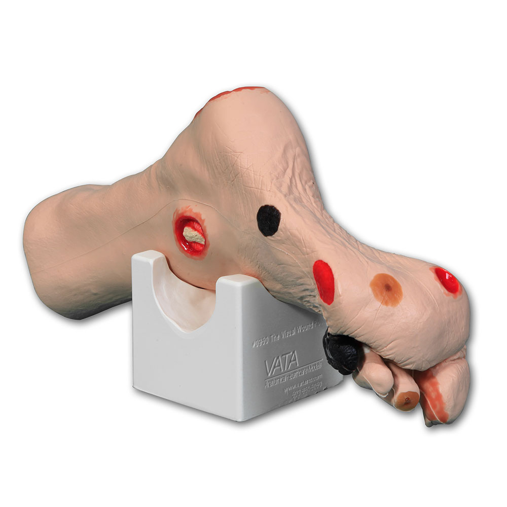 The Visual Wound Foot