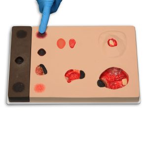 Pat Pressure Injury Staging Model™